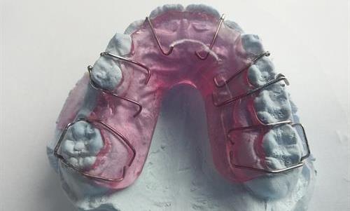 Ocean Dental Associates crowns and bridges