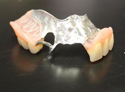 Ocean Dental Associates partials and dentures