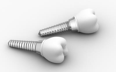 Ocean Dental Associates implants